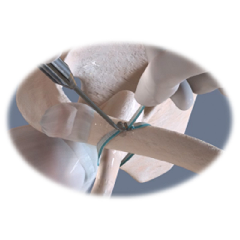 Novicoid 2